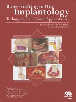Hardcover Bone Grafting in Oral Implantology: Techniques and Clinical Applications Book