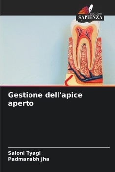 Paperback Gestione dell'apice aperto [Italian] Book