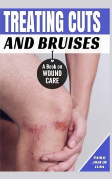 Paperback Treating Cuts and Bruises: A Book on Wound Care Book