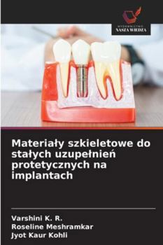 Materialy szkieletowe do stalych uzupelnien protetycznych na implantach (Polish Edition)