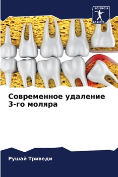 Paperback Современное удаление 3-го [Russian] Book