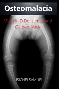 Osteomalacia: Vitamin D Deficiency And Osteomalacia