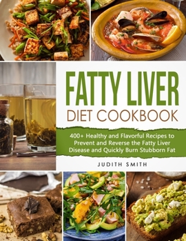 Paperback Fatty Liver Diet Cookbook: 400+ Healthy and Flavorful Recipes to Prevent and Reverse the Fatty Liver Disease and Quickly Burn Stubborn Fat Book