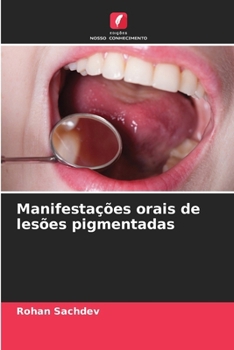 Paperback Manifestações orais de lesões pigmentadas [Portuguese] Book