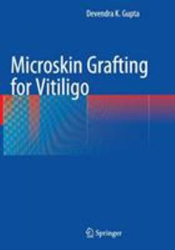 Microskin Grafting for Vitiligo