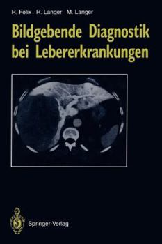 Paperback Bildgebende Diagnostik Bei Lebererkrankungen [German] Book