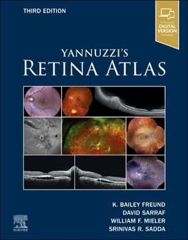 Hardcover Yannuzzi's Retina Atlas Book