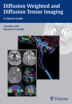 Paperback Diffusion Weighted and Diffusion Tensor Imaging: A Clinical Guide Book
