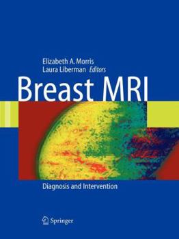 Paperback Breast MRI Book