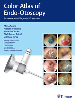 Hardcover Color Atlas of Endo-Otoscopy: Examination - Diagnosis - Treatment Book