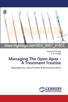Paperback Managing The Open Apex - A Treatment Treatise Book