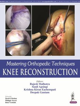 Hardcover Mastering Orthopedic Techniques: Knee Reconstruction Book