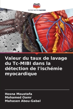 Valeur du taux de lavage du Tc-MIBI dans la détection de l'ischémie myocardique (French Edition)