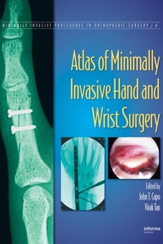 Hardcover Atlas of Minimally Invasive Hand and Wrist Surgery Book