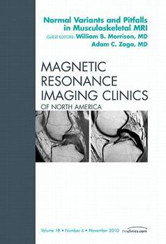 Hardcover Normal Variants and Pitfalls in Musculoskeletal Mri, an Issue of Magnetic Resonance Imaging Clinics: Volume 18-4 Book