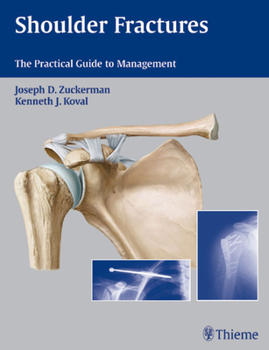 Hardcover Shoulder Fractures Book