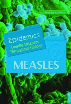 Library Binding Measles Book