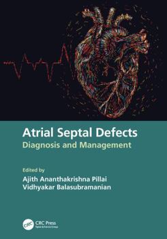Paperback Atrial Septal Defects: Diagnosis and Management Book
