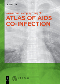 Paperback Atlas of AIDS Co-Infection Book