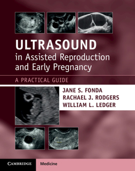 Paperback Ultrasound in Assisted Reproduction and Early Pregnancy: A Practical Guide Book