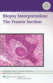 Hardcover Biopsy Interpretation: The Frozen Section [With Access Code] Book