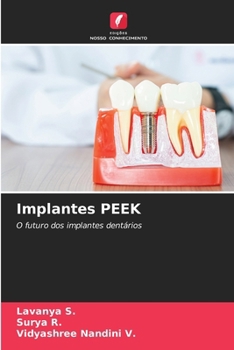 Paperback Implantes PEEK [Portuguese] Book