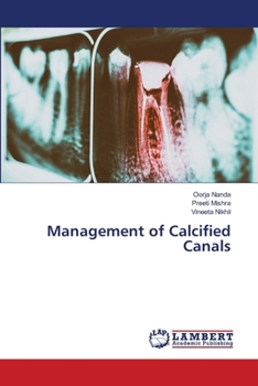 Paperback Management of Calcified Canals Book