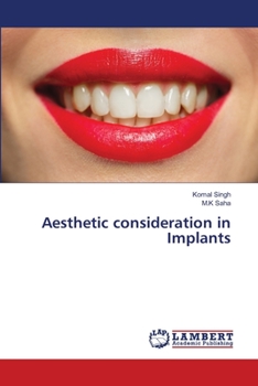 Paperback Aesthetic consideration in Implants Book