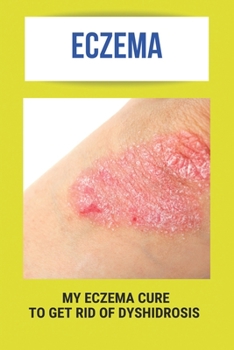 Paperback Eczema: My Eczema Cure To Get Rid Of Dyshidrosis: Nummular Eczema Book