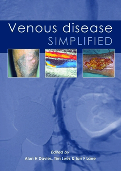 Paperback Venous Disease Simplified Book