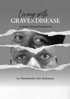 Paperback Living with Graves Disease: A South African Perspective Book