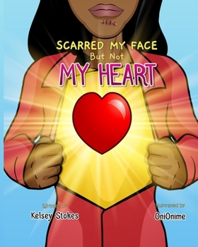 Paperback Scarred My Face But Not My Heart Book