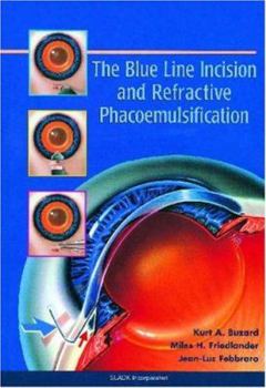 Hardcover The Blue Line Incision and Refractive Phacoemulsification Book