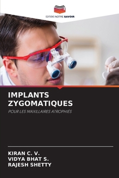 Paperback Implants Zygomatiques [French] Book