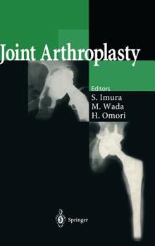 Hardcover Joint Arthroplasty Book