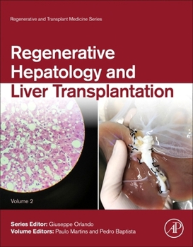 Hardcover Regenerative Hepatology and Liver Transplantation: Volume 2 Book