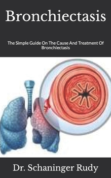 Paperback Bronchiectasis: The Simple Guide On The Cause And Treatment Of Bronchiectasis Book