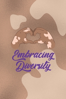 Paperback Embrace Diversity: Notebook Journal Composition Blank Lined Diary Notepad 120 Pages Paperback Brown Texture Vitiligo Book