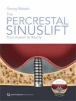 Hardcover The Percrestal Sinuslift: From Illusion to Reality Book