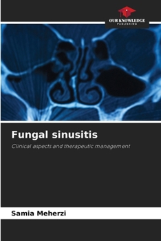 Paperback Fungal sinusitis Book