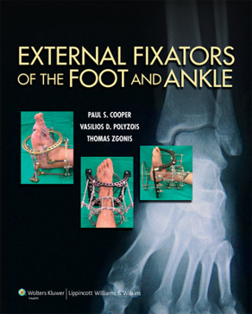 Hardcover External Fixators of the Foot and Ankle Book