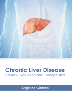 Hardcover Chronic Liver Disease: Causes, Evaluation and Therapeutics Book
