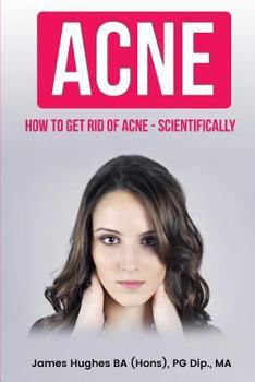 Paperback Acne: How to get rid of acne - scientifically Book