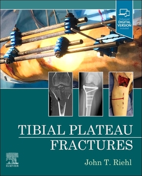 Hardcover Tibial Plateau Fractures Book