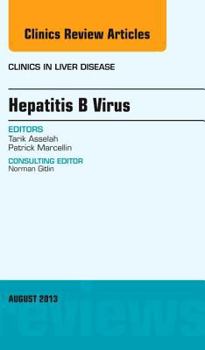 Hardcover Hepatitis B Virus, an Issue of Clinics in Liver Disease: Volume 17-3 Book