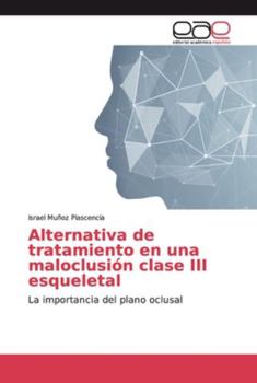 Paperback Alternativa de tratamiento en una maloclusión clase III esqueletal [Spanish] Book