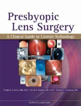 Presbyopic Lens Surgery: A Clinical Guide to Current Technology