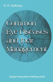 Paperback Common Eye Diseases and Their Management Book