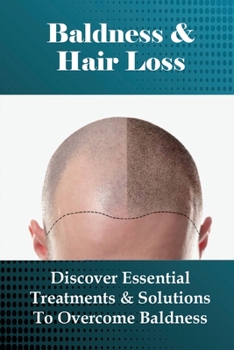Baldness & Hair Loss: Discover Essential Treatments & Solutions To Overcome Baldness: How To Prevent Hair Loss For Guys
