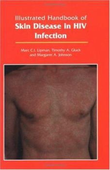 Paperback Illustrated Handbook of Skin Disease in HIV Infection Book